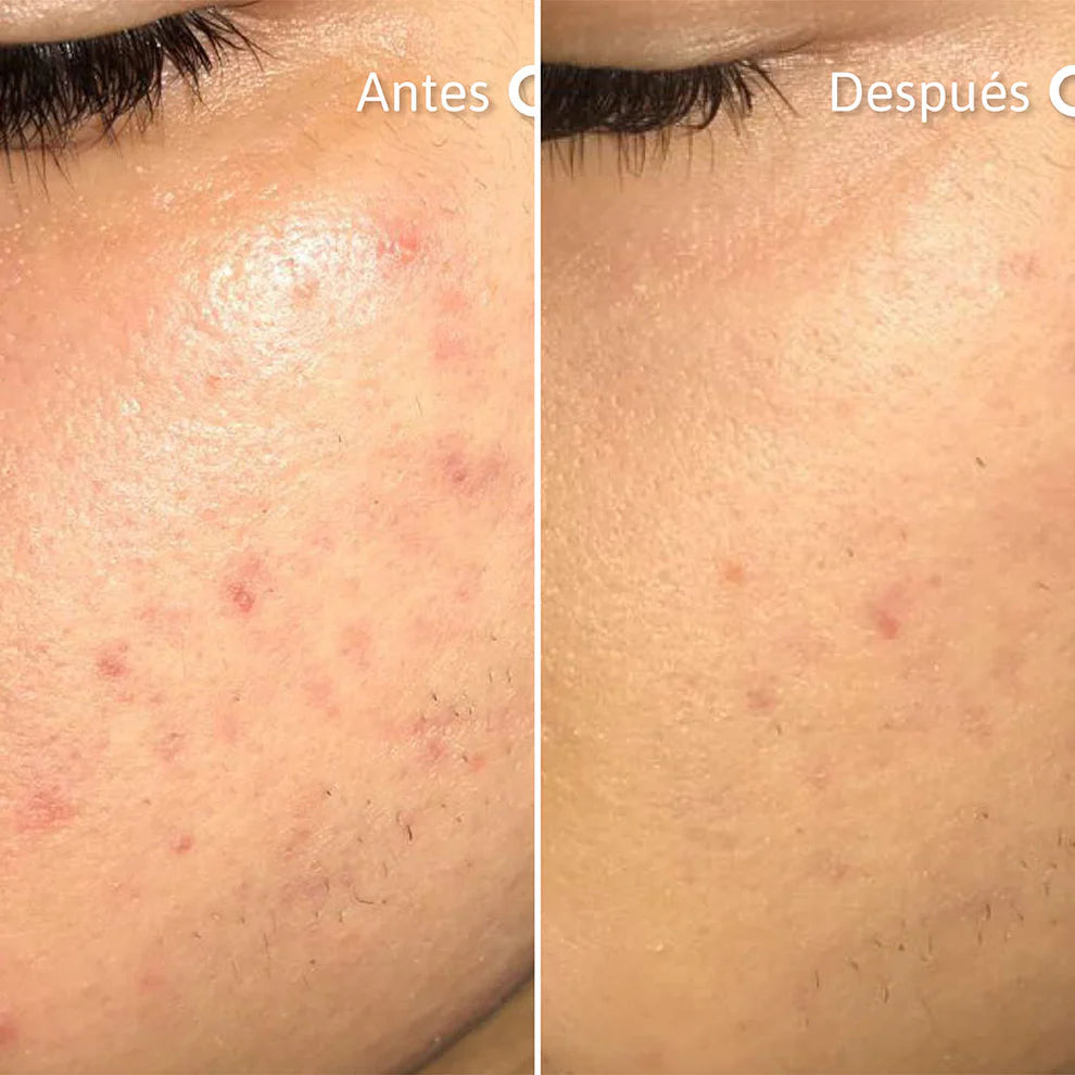 Niacik Serum™: Alpha Arbutin + Niacinamida